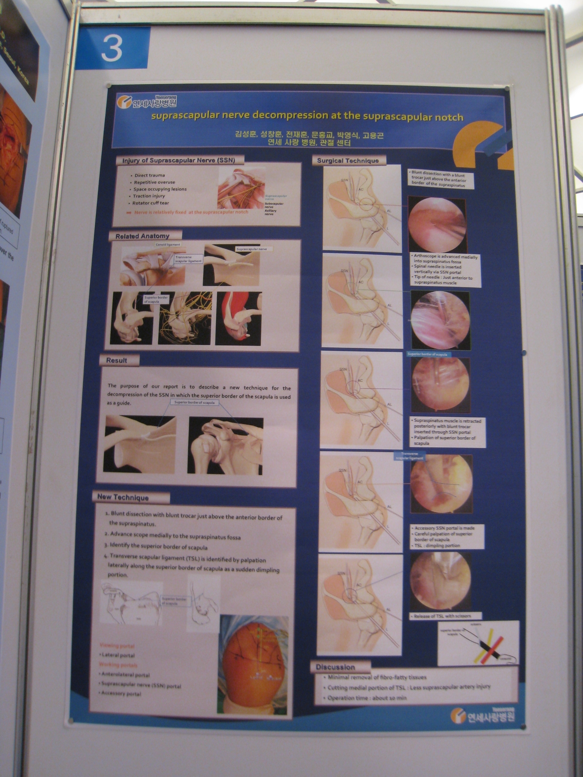 [2009 대한정형외과 학회 포스터] 관절 내시경을 이용한 견갑상 절흔에서의 견감상 신경 감압술 게시글의 1번째 첨부파일입니다.
