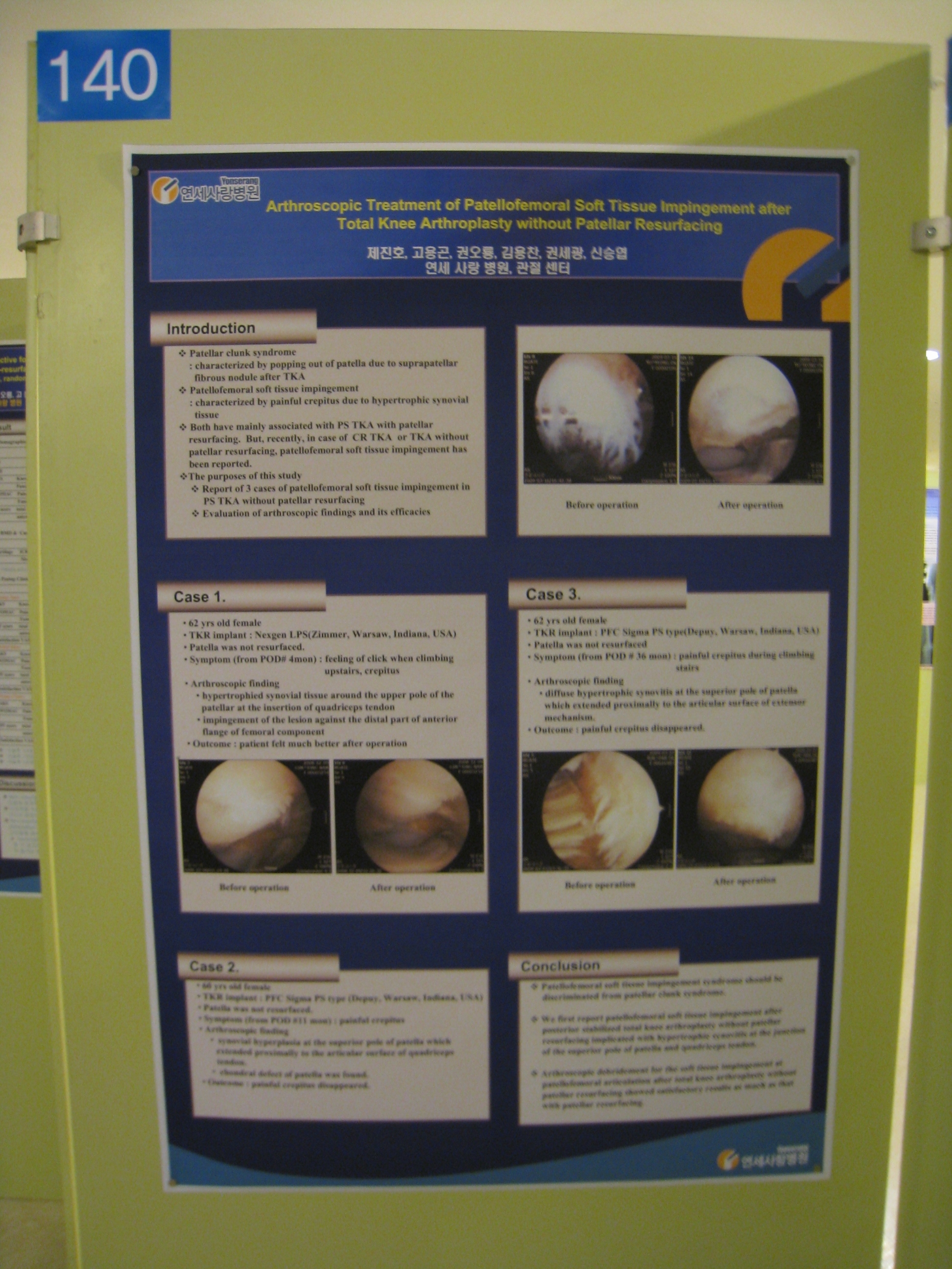 [2009 대한정형외과 학회 포스터]슬개골을 치환하지 않은 인공슬관절 전치환술에서의 슬개골 감입 증후군 게시글의 1번째 첨부파일입니다.