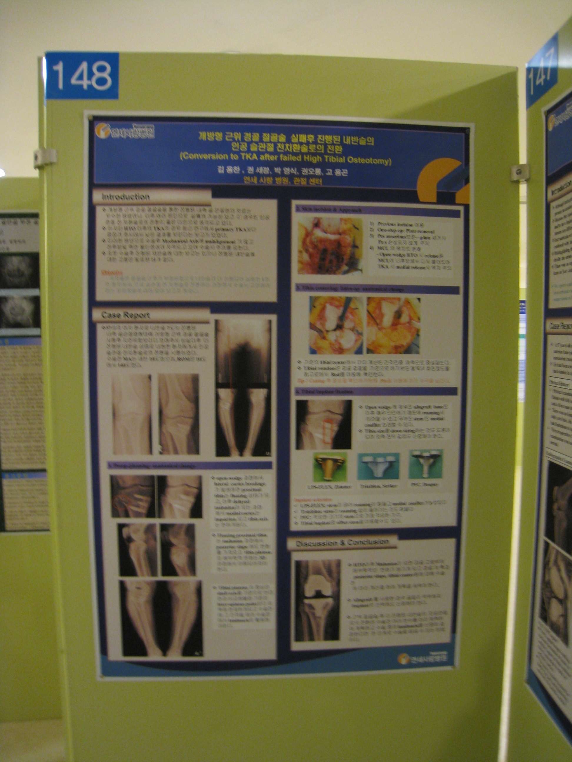 [2009 대한정형외과 학회 포스터] 개방형 근위 경골 절골술 실패 후 인공 슬관절 전치환술로 전환 게시글의 1번째 첨부파일입니다.