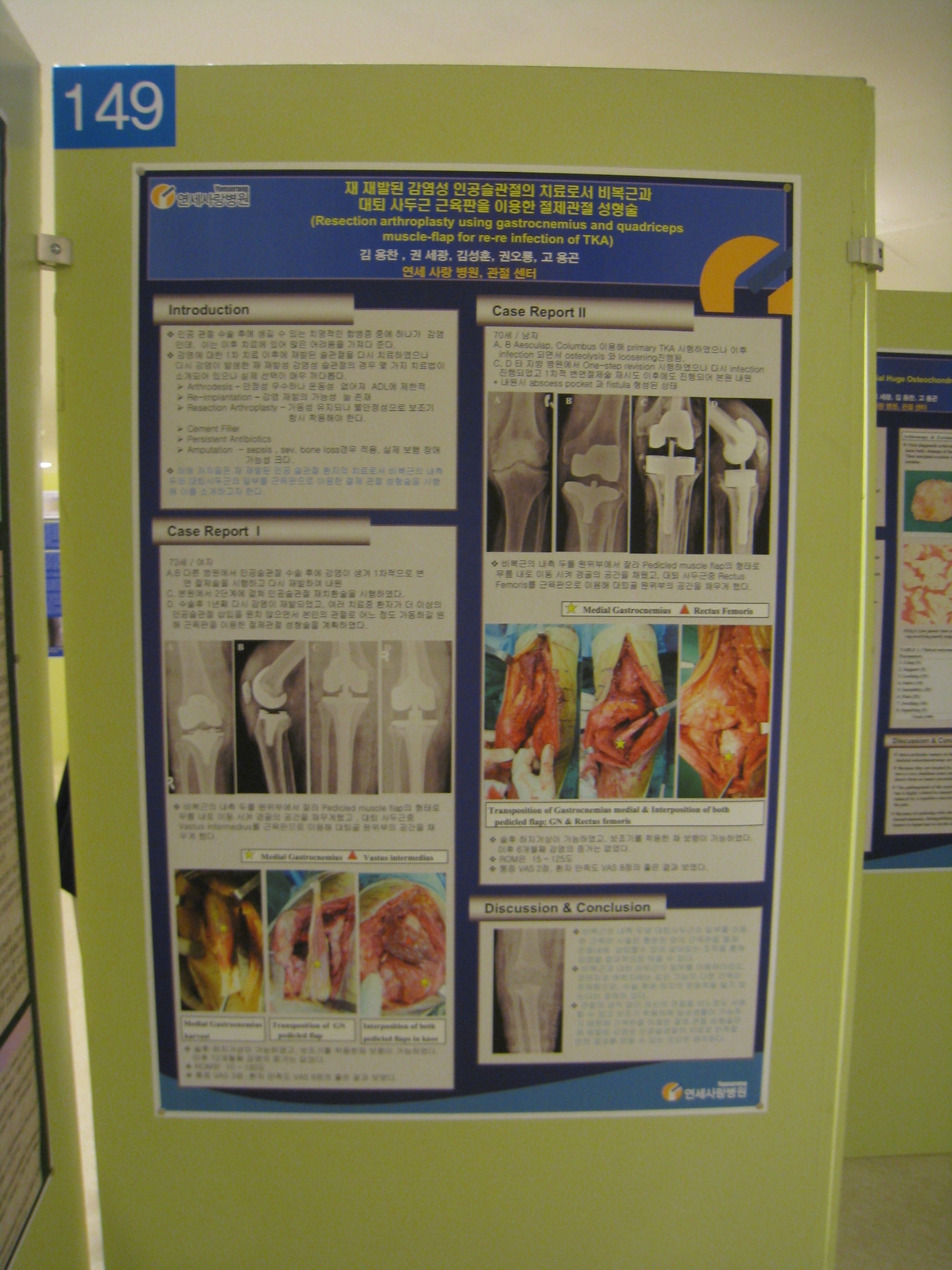 [2009 대한정형외과 학회 포스터] 재발된 감염성 인공슬관절의 치료로서 비복근과 대퇴 사두근 근육판을 이용한 절제 관절 성형술 게시글의 1번째 첨부파일입니다.