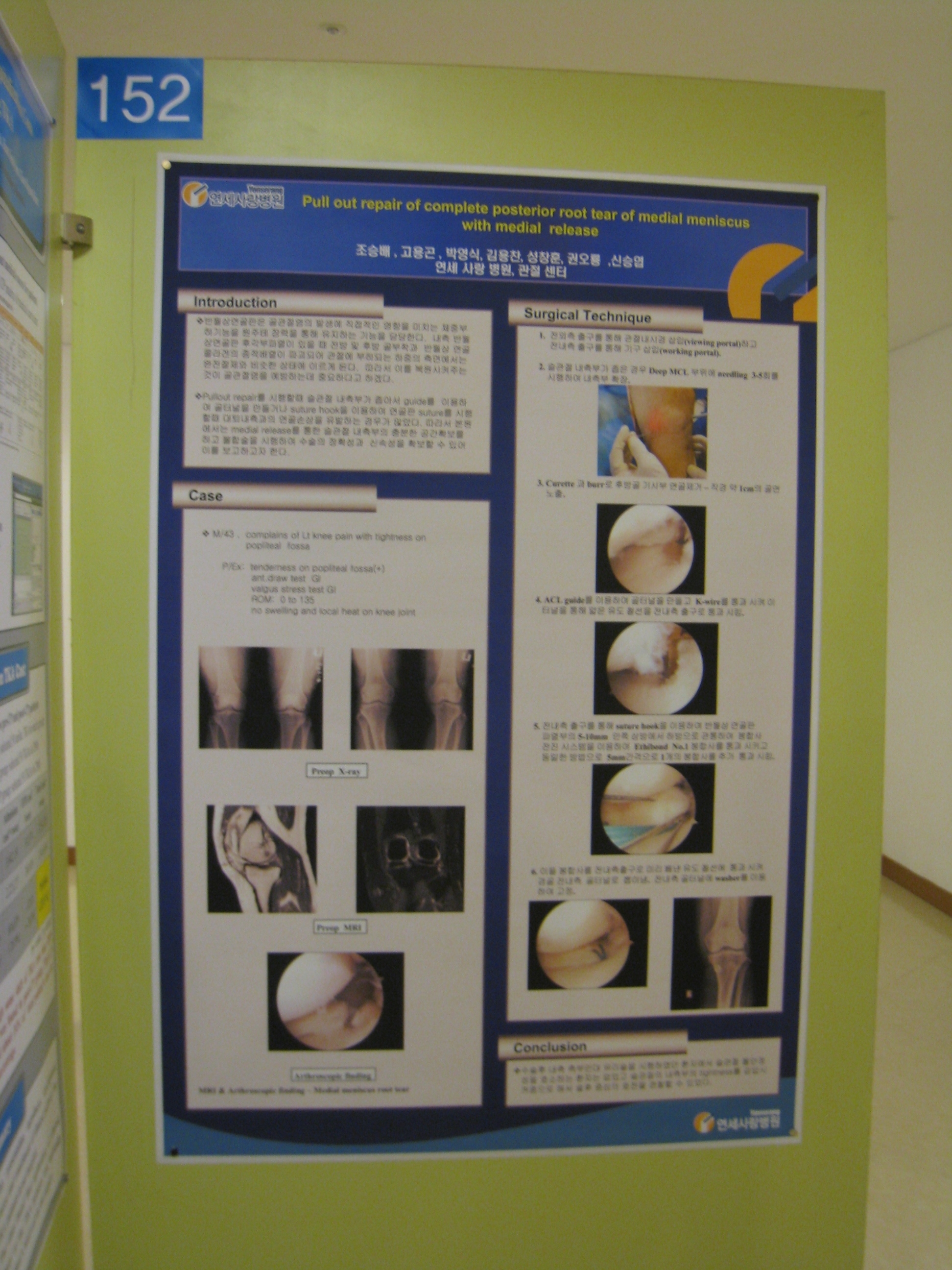 [2009 대한정형외과 학회 포스터] 내측측부 유리술을 이용한 내측 반월상 연골판 후각부 봉합술 게시글의 1번째 첨부파일입니다.