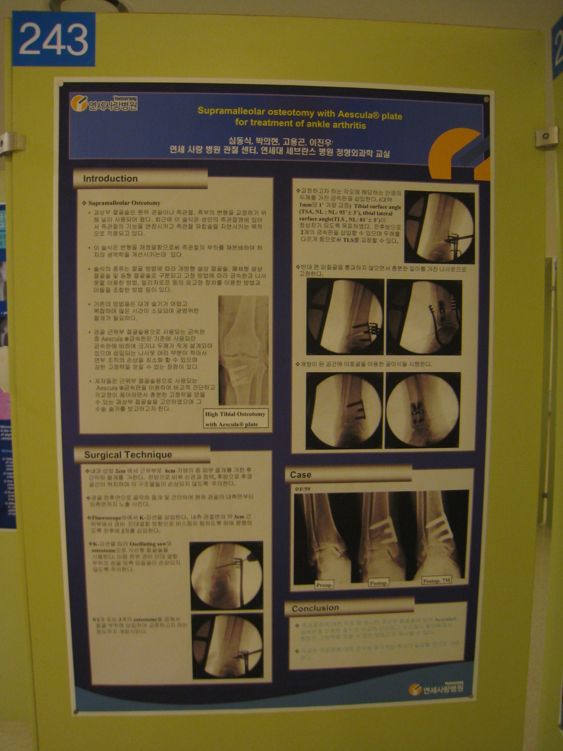 [2009 대한정형외과 학회 포스터] 족관절 관절염 치료 시 Aescula  금속판을 이용한 과상방 절골술 게시글의 1번째 첨부파일입니다.
